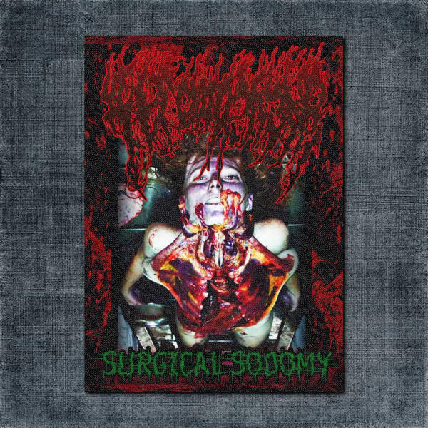 Aeteratoma Back Patch, Aeteratoma - Surgical Sodomy Big Back Patch