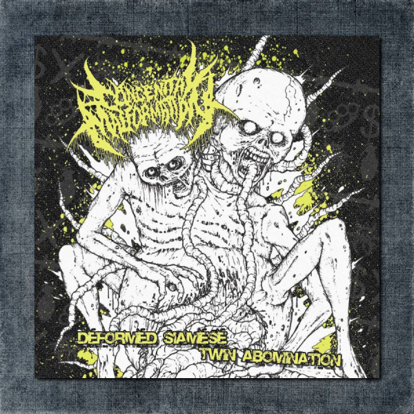 Congenital Malformation Back Patch, Congenital Malformation - Deformed Siamese Twin Abomination Big Back Patch