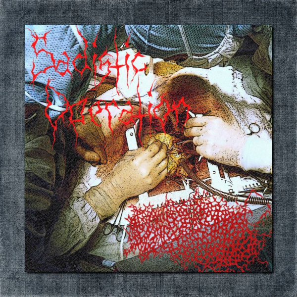 Ingested Lobotomized Remains Back Patch, Ingested Lobotomized Remains - Sadistic Operation Big Back Patch